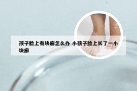 孩子脸上有块癣怎么办 小孩子脸上长了一小块癣