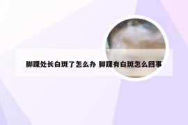 脚踝处长白斑了怎么办 脚踝有白斑怎么回事