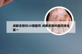 成都皮肤科10强医院 成都皮肤科医院排名第一