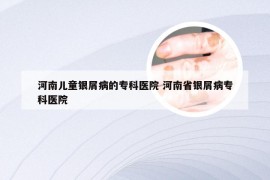 河南儿童银屑病的专科医院 河南省银屑病专科医院