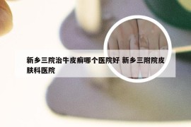 新乡三院治牛皮癣哪个医院好 新乡三附院皮肤科医院