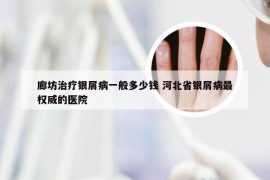 廊坊治疗银屑病一般多少钱 河北省银屑病最权威的医院