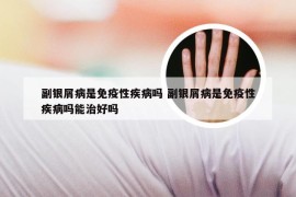 副银屑病是免疫性疾病吗 副银屑病是免疫性疾病吗能治好吗