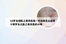 14岁女孩脸上突然出现一片白斑怎么回事 十四岁女儿脸上有白色的小块