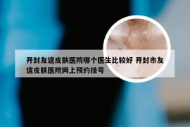 开封友谊皮肤医院哪个医生比较好 开封市友谊皮肤医院网上预约挂号