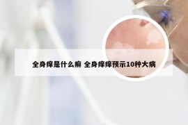 全身痒是什么癣 全身痒痒预示10种大病