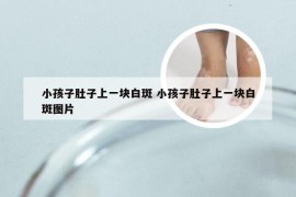 小孩子肚子上一块白斑 小孩子肚子上一块白斑图片