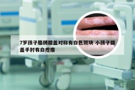 7岁孩子胳膊膝盖对称有白色斑块 小孩子膝盖手肘有白疙瘩