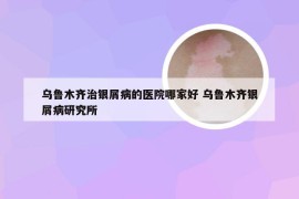 乌鲁木齐治银屑病的医院哪家好 乌鲁木齐银屑病研究所