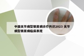 中国关节病型银屑病诊疗共识2023 关节病型银屑病临床表现