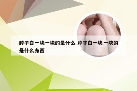 脖子白一块一块的是什么 脖子白一块一块的是什么东西