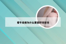 看牛皮癣为什么要查肝功肾功