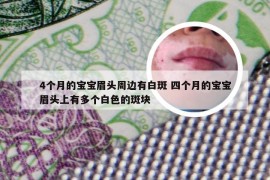 4个月的宝宝眉头周边有白斑 四个月的宝宝眉头上有多个白色的斑块