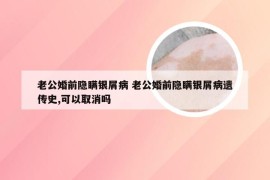 老公婚前隐瞒银屑病 老公婚前隐瞒银屑病遗传史,可以取消吗