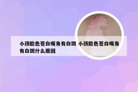 小孩脸色苍白嘴角有白斑 小孩脸色苍白嘴角有白斑什么原因