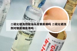 二硫化硒洗剂能治头皮银屑病吗 二硫化硒洗剂对银屑病有用吗