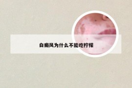 白癜风为什么不能吃柠檬