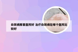 白斑病那里医院好 治疗白斑病在哪个医院比较好