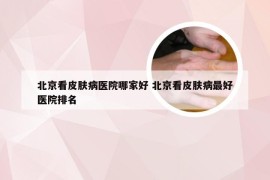 北京看皮肤病医院哪家好 北京看皮肤病最好医院排名