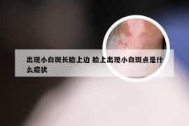 出现小白斑长脸上边 脸上出现小白斑点是什么症状