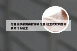 检查皮肤病需要做哪些检查 检查皮肤病都需要做什么检查