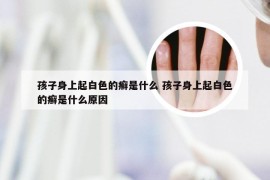 孩子身上起白色的癣是什么 孩子身上起白色的癣是什么原因