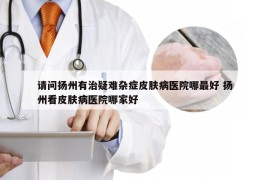 请问扬州有治疑难杂症皮肤病医院哪最好 扬州看皮肤病医院哪家好