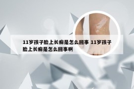 11岁孩子脸上长癣是怎么回事 11岁孩子脸上长癣是怎么回事啊