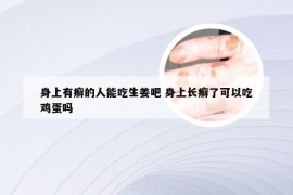 身上有癣的人能吃生姜吧 身上长癣了可以吃鸡蛋吗