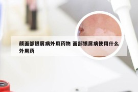 颜面部银屑病外用药物 面部银屑病使用什么外用药