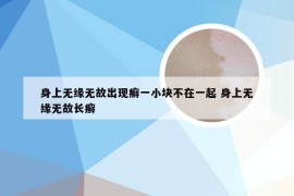 身上无缘无故出现癣一小块不在一起 身上无缘无故长癣