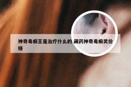 神奇毒癣王是治疗什么的 藏药神奇毒癣灵价格