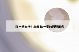 陈一堂治疗牛皮癣 陈一堂的药管用吗