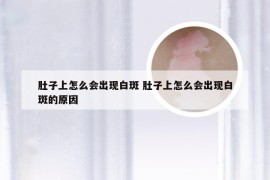 肚子上怎么会出现白斑 肚子上怎么会出现白斑的原因