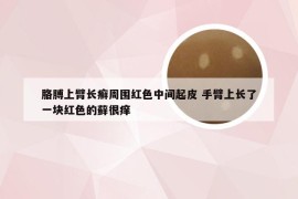 胳膊上臂长癣周围红色中间起皮 手臂上长了一块红色的藓很痒