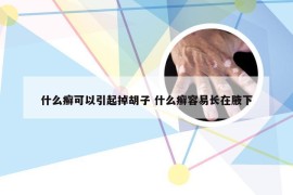 什么癣可以引起掉胡子 什么癣容易长在腋下