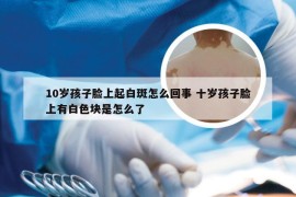 10岁孩子脸上起白斑怎么回事 十岁孩子脸上有白色块是怎么了