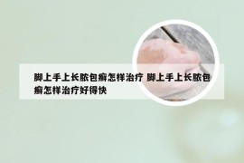 脚上手上长脓包癣怎样治疗 脚上手上长脓包癣怎样治疗好得快