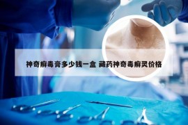 神奇癣毒膏多少钱一盒 藏药神奇毒癣灵价格