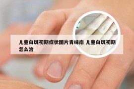 儿童白斑初期症状图片青睐南 儿童白斑初期怎么治