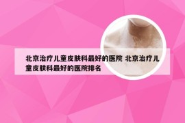 北京治疗儿童皮肤科最好的医院 北京治疗儿童皮肤科最好的医院排名