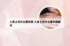 人身上为什么要长癣 人身上为什么要长癣图片