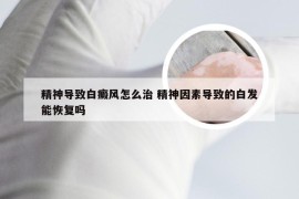 精神导致白癜风怎么治 精神因素导致的白发能恢复吗