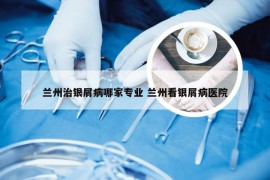 兰州治银屑病哪家专业 兰州看银屑病医院