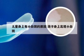 儿童身上有小白斑的原因 孩子身上出现小白斑