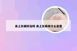 身上长癣好治吗 身上长癣有什么危害