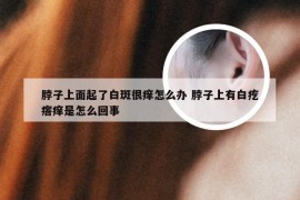 脖子上面起了白斑很痒怎么办 脖子上有白疙瘩痒是怎么回事