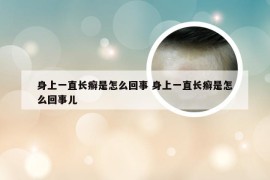 身上一直长癣是怎么回事 身上一直长癣是怎么回事儿