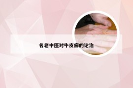 名老中医对牛皮癣的论治