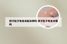 孩子肚子有虫会起白斑吗 孩子肚子有虫会瘦吗